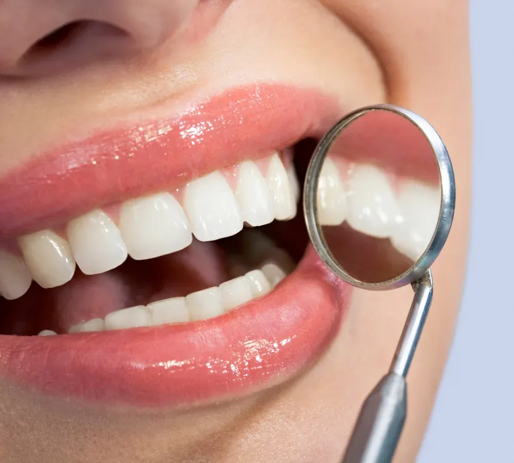 Cosmetic Bonding at Southeastern Dental Care in Lakeville, MA